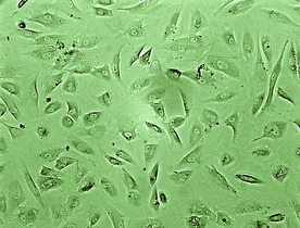 Monolayer appearance of cultured human chondrocytes with invers microscopy